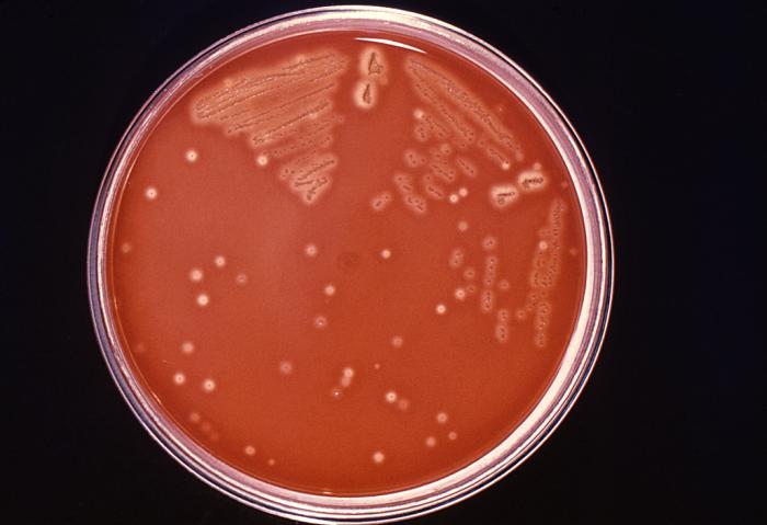 Petri dish with Streptococcus pyogenes-inoculated trypticase soy agar on blood agar plate (BAP). From Public Health Image Library (PHIL). [14]