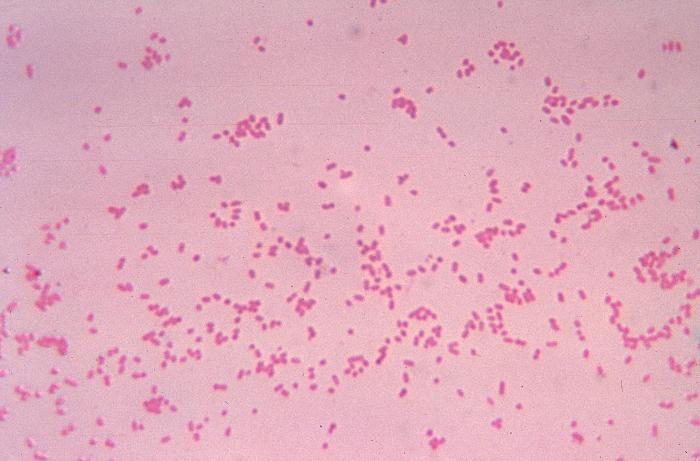 File:Bacteroides32.jpeg