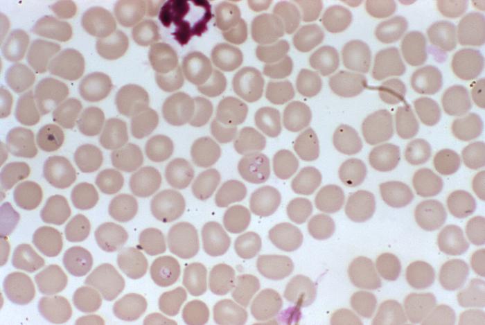 At a magnification of 1000X, this blood smear photomicrograph revealed the presence of a number of intra-erythrocytic forms of Babesia sp. hemoprotozoan parasites. From Public Health Image Library (PHIL). [2]