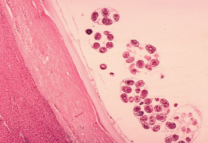 Histopathology of Echinococcus granulosus hydatid cyst in a sheep. From Public Health Image Library (PHIL). [1]