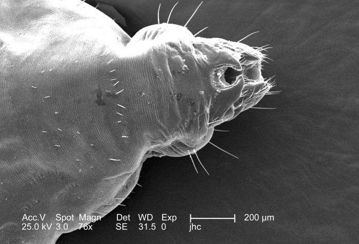 Scanning electron micrograph (SEM) reveals the distal tip of the abdominal region of a female body louse, Pediculus humanus var. corporis from a dorsal perspective (152X mag). From Public Health Image Library (PHIL). [1]