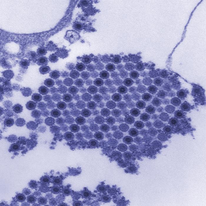 Transmission electron micrograph (TEM) depicts numerous Chikungunya virus particles. From Public Health Image Library (PHIL). [21]