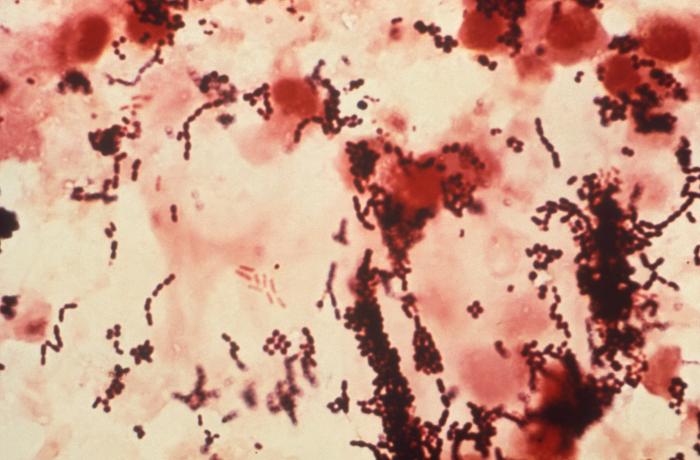 This photomicrograph of an unknown sample revealed the presence of a mixed infection, which involved Gram-positive Peptostreptococcus anaerobius and P. asaccharolyticus (formerly Peptococcus asaccharolyticus), and Gram-negative Prevotella melaninogenica (formerly Bacteroides melaninogenicus), anaerobic bacteria. From Public Health Image Library (PHIL). [8]