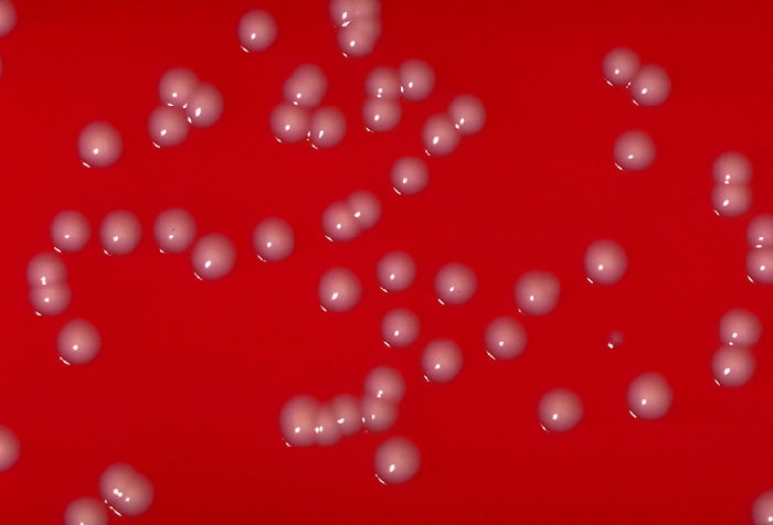 C. ulcerans colonies on a blood agar plate. - Pubblico dominio, https://commons.wikimedia.org/w/index.php?curid=1868432