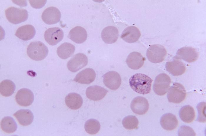 Magnified 1125X, this thin film photomicrograph of a blood smear, revealed the presence of a ring-formPlasmodium vivax trophozoite (upper left), and a growing amoeboid trophozoite displaying intracytoplasmic Schüffner's dots (right). Adapted from Public Health Image Library (PHIL), Centers for Disease Control and Prevention.[6]