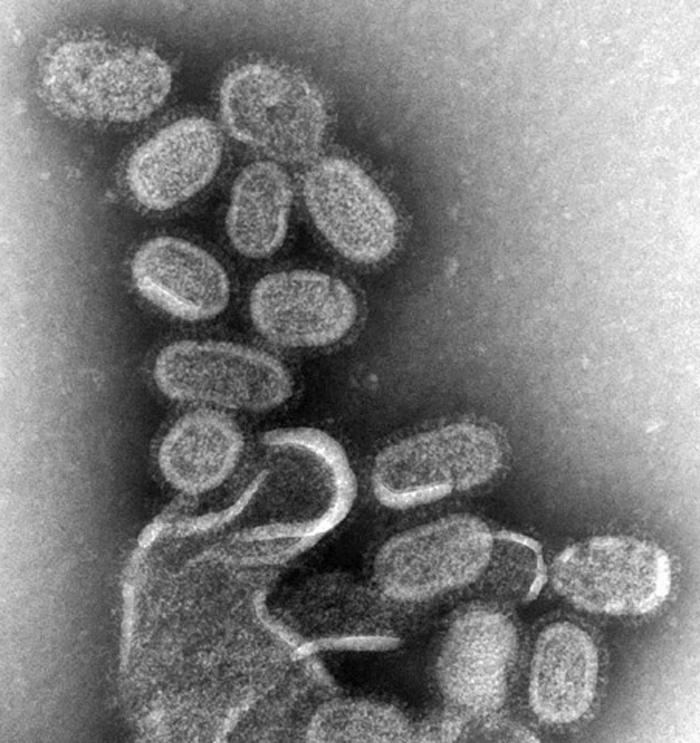 EM of influenza virus.jpg