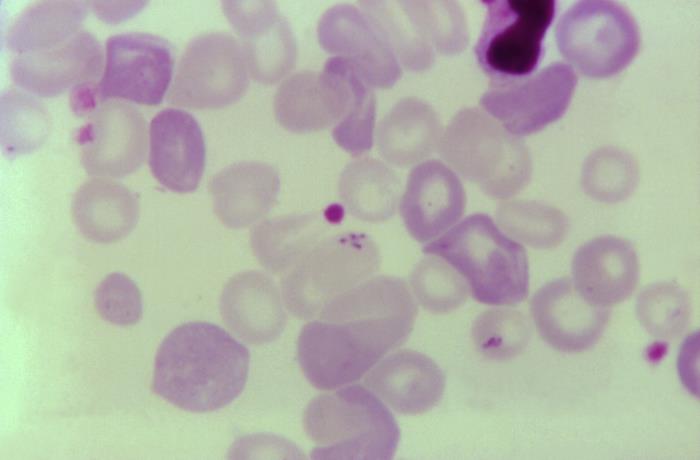 This blood smear micrograph reveals a Babesia sp. tetrad formation. From Public Health Image Library (PHIL). [2]