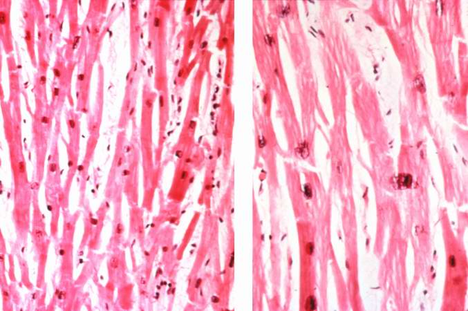 hypertrophy muscle microscope