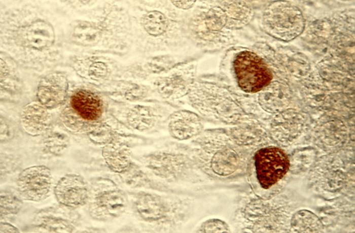 C. trachomatis inclusion bodies (brown) in a McCoy cell culture - Source: https://www.cdc.gov/