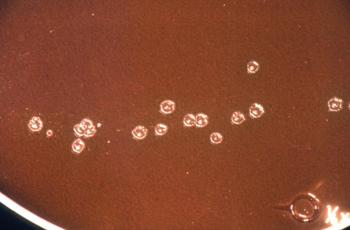 Photomicrograph reveals presence of intracellular Gram-negative, Neisseria gonorrhoeae diplococcal bacteria. From Public Health Image Library (PHIL). [1]