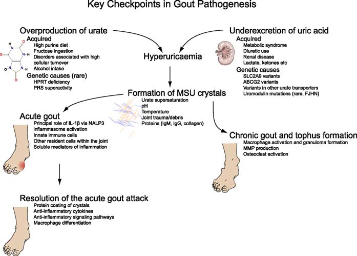Numerous factors and conditions responsible for the development of gout