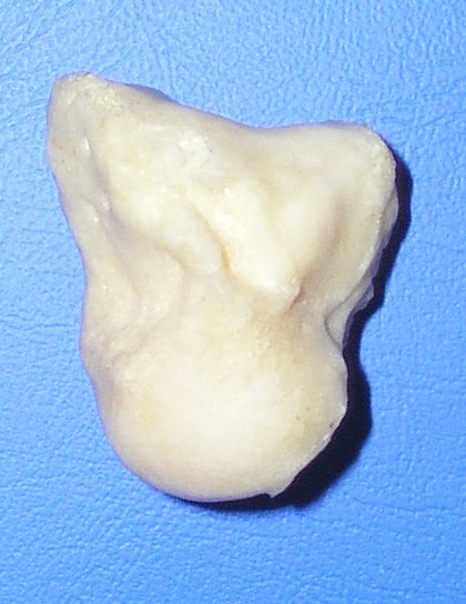 Os capitatum of the left hand, dorsal surface