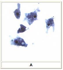 Naegleria fowleri trophozoites