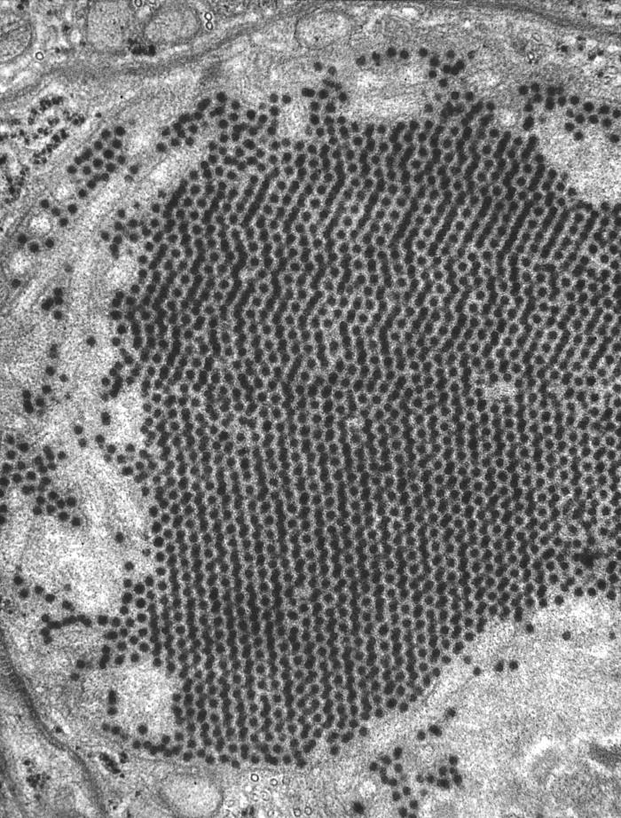 Transmission electron micrograph (TEM) reveals the presence of numerous St. Louis encephalitis virions that were contained within a mosquito salivary gland tissue sample. From Public Health Image Library (PHIL). [2]