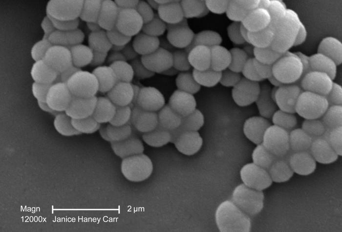 Scanning electron micrograph (SEM) revealed a cluster of Gram-positive, beta-hemolytic Group C Streptococcus sp. bacteria. From Public Health Image Library (PHIL). [10]