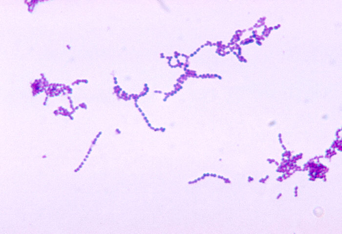 File:Group A streptococcus30.jpeg