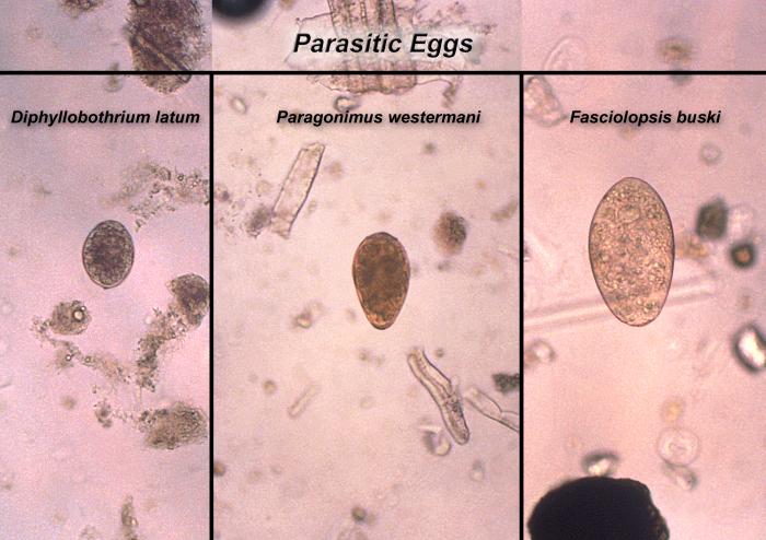 Image compares the size relationship between three different parasitic eggs. From Public Health Image Library (PHIL). [4]