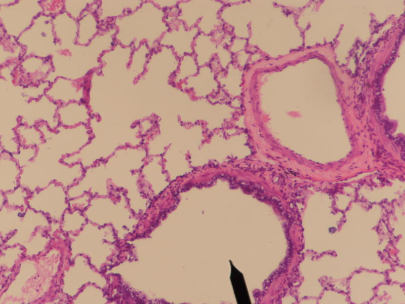 Cross sectional cut of primary bronchiole