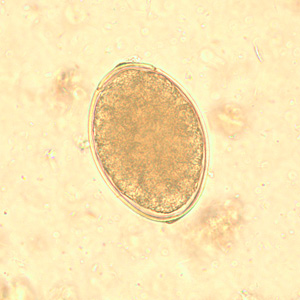 Egg of Diphyllobothrium latum with an operculum. Markings are 1 mm apart.