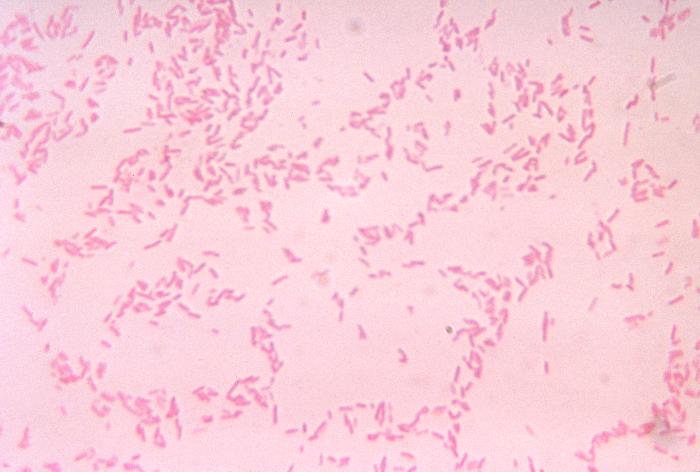 File:Bacteroides28.jpeg