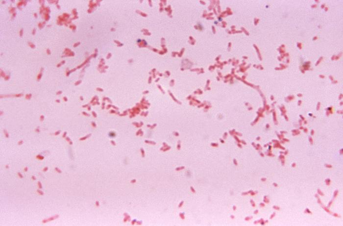 File:Fusobacterium19.jpeg