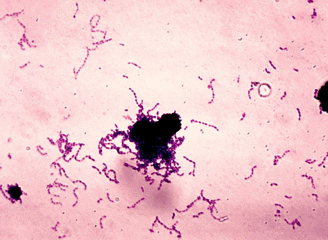 Gram stain of S. mutans in thioglycollate broth culture.