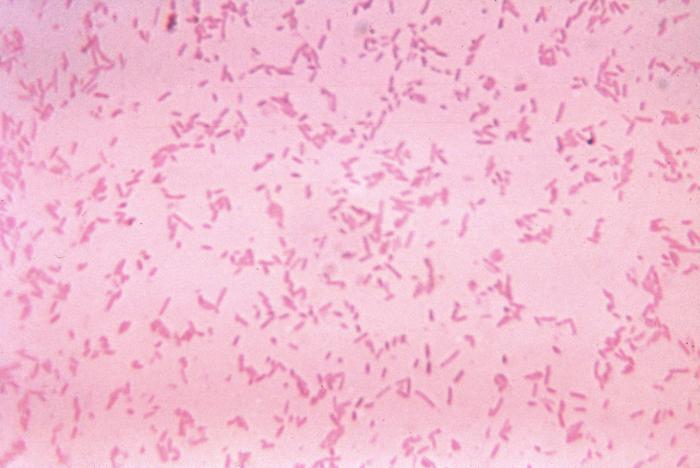 This photomicrograph shows Fusobacterium novum after being cultured in a thioglycollate medium for 48 hours. From Public Health Image Library (PHIL). [7]