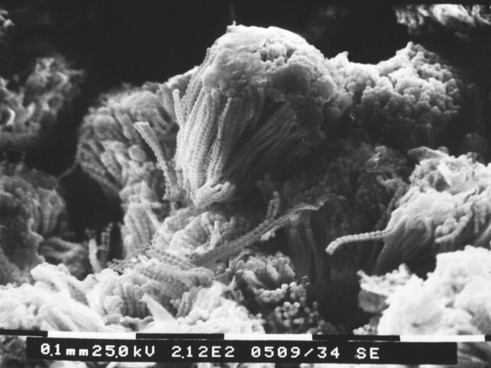 This scanning electron micrograph (SEM) depicts numbers of round asexual Aspergillus sp. fungal fruiting bodies situated amongst a patch of the organism’s septate hyphae. Numbers of chains of conidiospores are visible in this view. From Public Health Image Library (PHIL). [2]