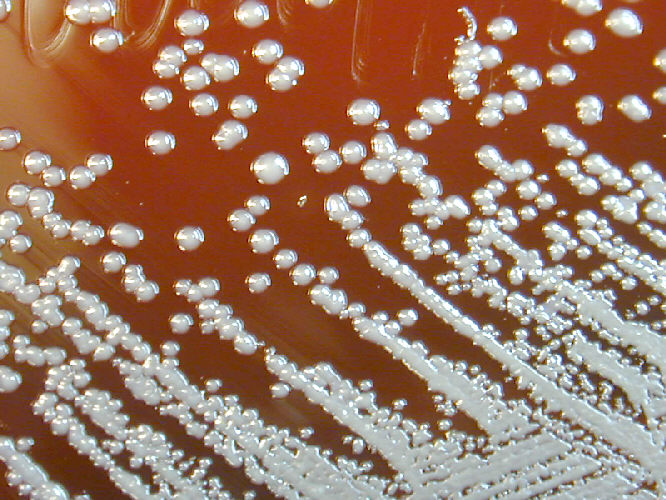 Burkholderia pseudomallei grown on sheep blood agar for 48 hours. From Public Health Image Library (PHIL). [13]