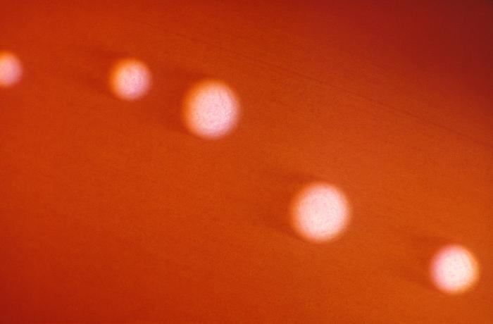 Under a low magnification of 15x, this image depicts five colonies of Bacteroides variabilis bacteria. From Public Health Image Library (PHIL). [7]