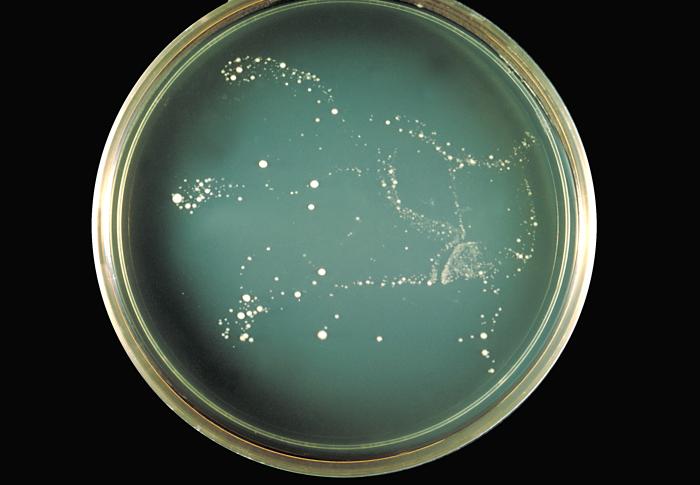 Encapsulated yeast Cryptococcus neoformans. From Public Health Image Library (PHIL). [1]