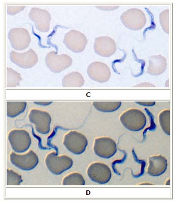 African trypanosomiasis 2 and 3