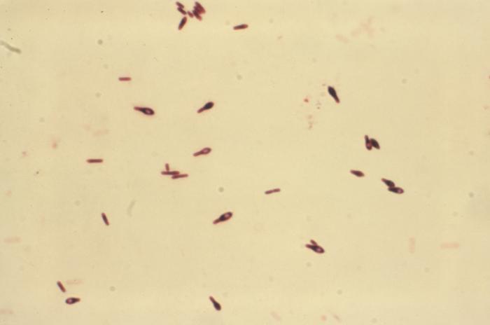 Clostridium botulinum Type-A in thioglycollate broth was incubated for 48hrs. From Public Health Image Library (PHIL). [7]