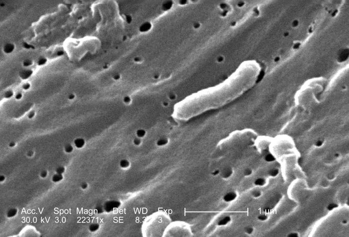 Scanning electron micrograph (SEM) depicts a number of Vibrio cholerae bacteria of the serogroup 01; Magnified 22371x. From Public Health Image Library (PHIL). [4]