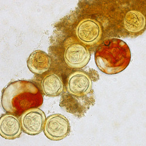 Eggs of Bertiella sp. liberated from proglottids. The proglottids were shed from a human patient who had lived for a number of years in Africa. In several of these eggs, the pyriform apparatus can be easily seen. Images courtesy of Clinipath Pathology, Perth, Australia. [hhttp://www.cdc.gov/dpdx/bertiella/gallery.html/ Adapted from CDC]