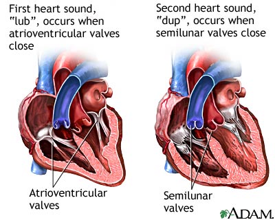 Heart sounds - wikidoc ant thorax diagram 