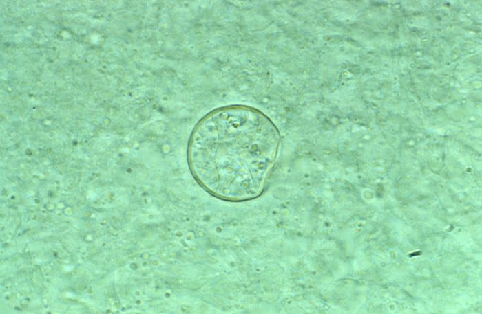 Histopathologic characteristics found within a pus specimen, prepared using potassium hudroxide (KOH). Specimen harvested from a skin lesion in a case of cutaneous coccidioidomycosis. From Public Health Image Library (PHIL). [5]