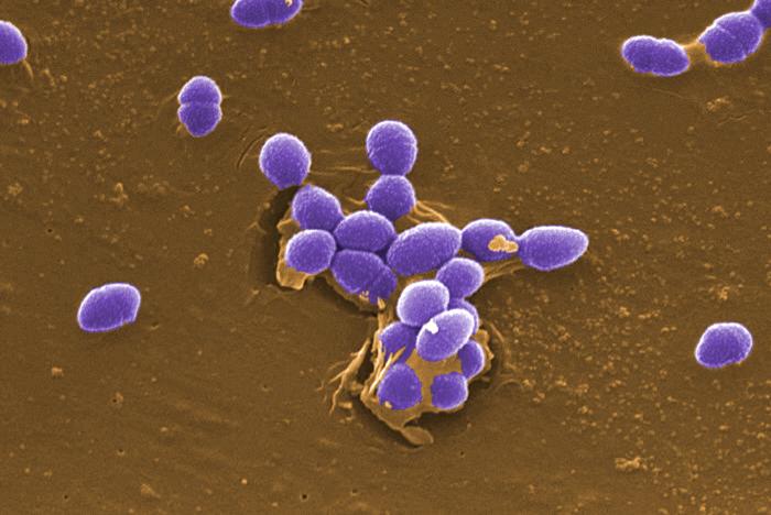 SEM depicts Gram-positive Enterococcus faecalis sp. bacteria. From Public Health Image Library (PHIL). [4]