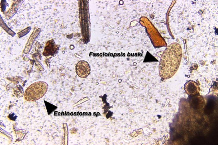 Fasciolopsis buski egg on the right found in an unstained formalin-preserved stool sample (125X mag). From Public Health Image Library (PHIL). [4]