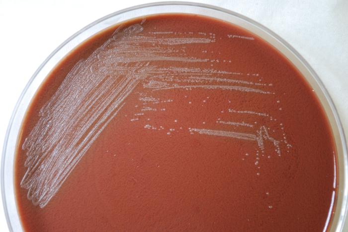 Gram-negative Yersinia pestis bacteria, grown on a medium of chocolate agar 24hrs. From Public Health Image Library (PHIL). [6]