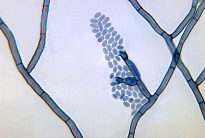 Photomicrograph depicts a conidia-laden conidiophore of a Phialophora verrucosa fungal organism from a slide culture. From Public Health Image Library (PHIL). [2]