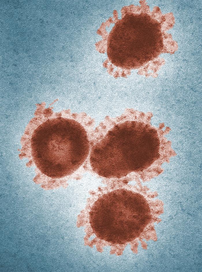 TEM revealed the presence of a number of infectious bronchitis virus (IBV) virions. From Public Health Image Library (PHIL). [1]