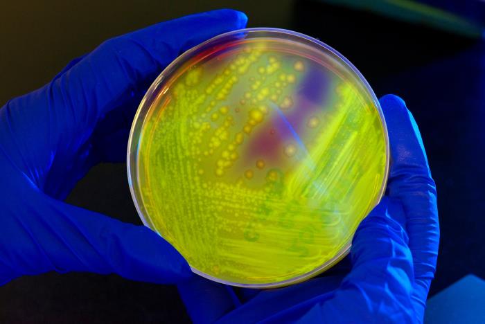Petri dish culture plate had contained Cycloserine Cefoxitin Fructose Agar (CCFA), inoculated with a Clostridium difficile bacterial culture. From Public Health Image Library (PHIL). [1]