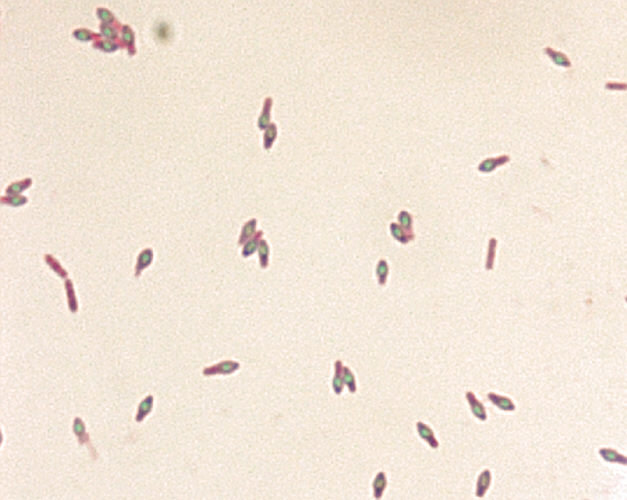 Clostridium botulinum spores stained with malachite green stain. From Public Health Image Library (PHIL). [7]