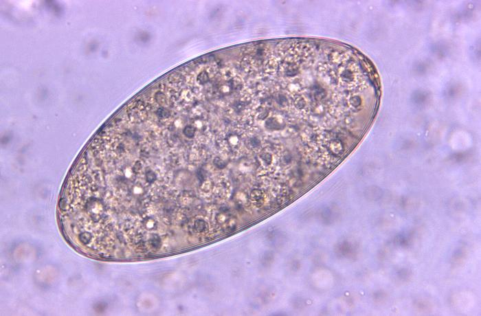 Egg of the giant intestinal fluke, Fasciolopsis buski (500x mag). From Public Health Image Library (PHIL). [4]