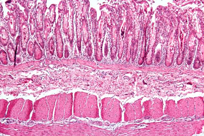 This is a low-power photomicrograph from another section of the intestine. Saggital sections of the intestinal crypts show the crypts along their full length, extending to the mucosal surface.