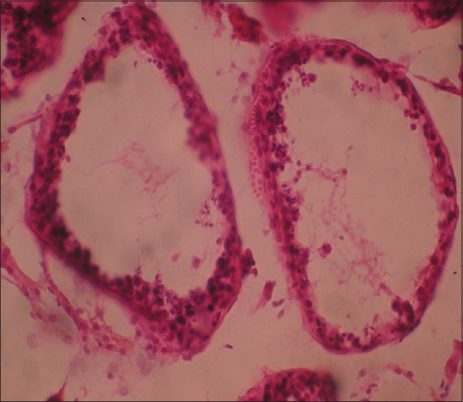 Microphotograph showing histopathology of testis by Bhaskararao G, Himabindu Y, Nayak SR, Sriharibabu M, from the Journal of Human Reproductive Sciences. Creative Commons Attribution License (http://creativecommons.org/licenses/by-nc/3.0). [16]