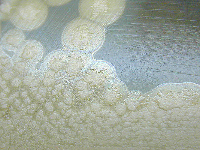 Clostridium botulinum growing on egg yolk agar showing the lipase reaction 72hrs. From Public Health Image Library (PHIL). [7]
