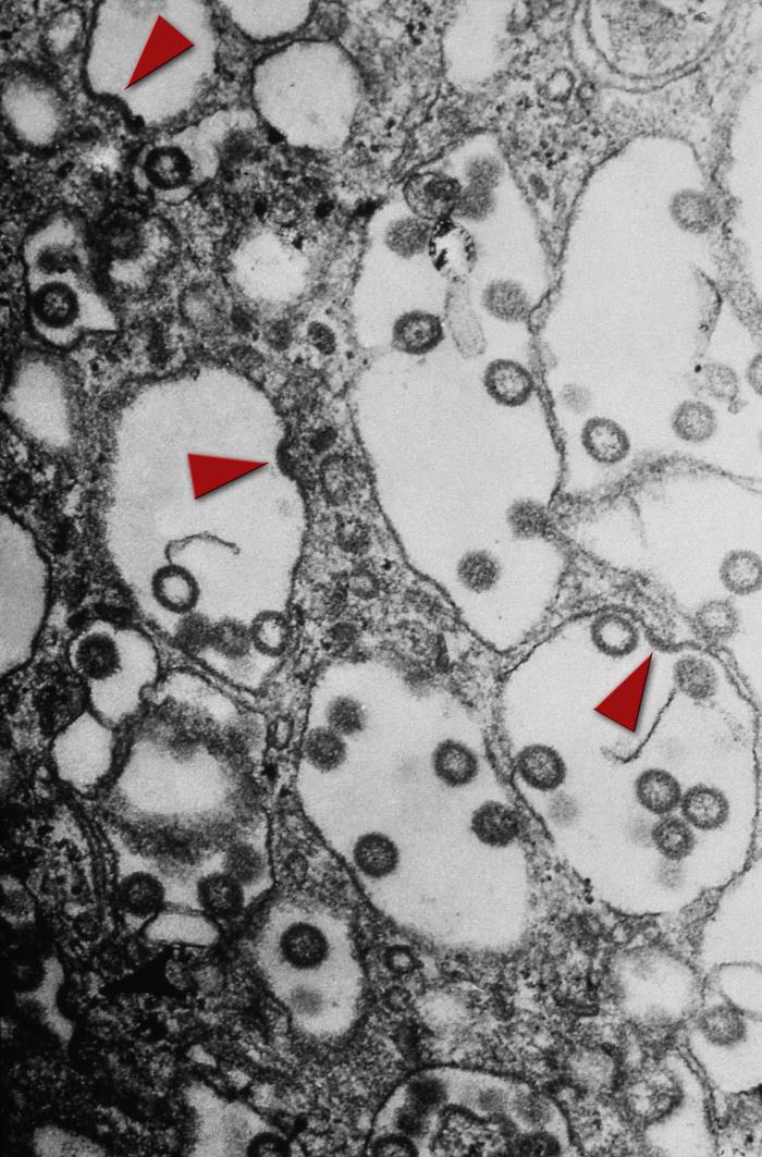 High magnification transmission electron micrograph (TEM) reveals some of the ultrastructural morphology seen in an unknown tissue sample, which had been caused by the spherical-shaped, enveloped Rift Valley fever (RVF) virus. Virions budding from the cell membrane are indicated by arrowheads. From Public Health Image Library (PHIL). [8]