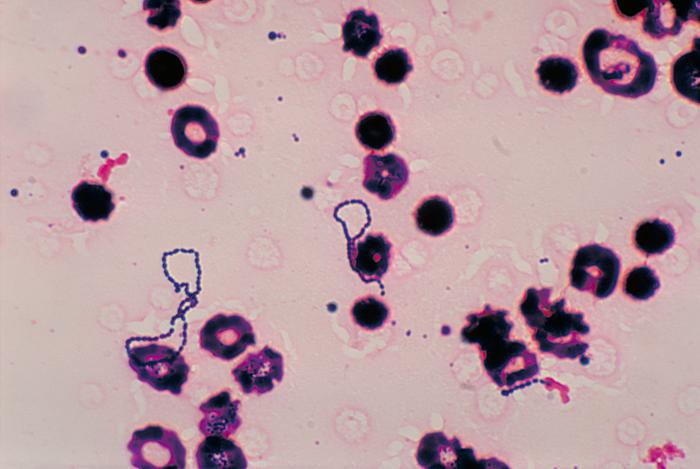 Blood culture specimen, depicts numbers of Gram-positive, a-hemolytic viridans streptococci group bacteria. From Public Health Image Library (PHIL). [3]